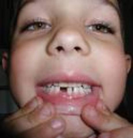 When you lost your first tooth...