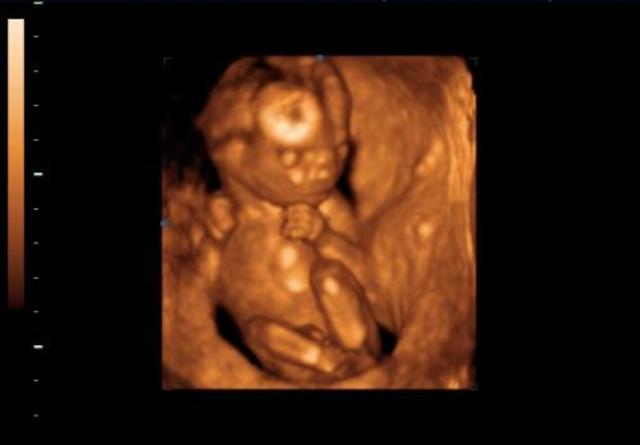 A magzat fejlődése a negyedik hónapban