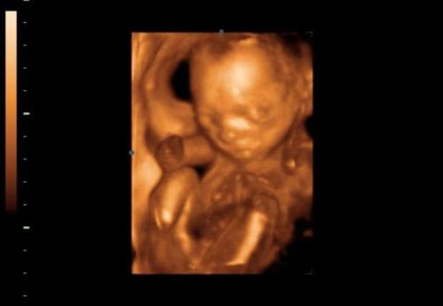 A magzat fejlődése az ötödik hónapban