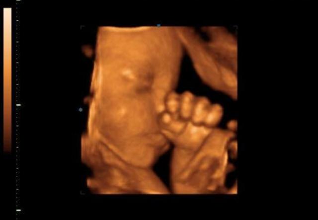 A magzat fejlődése a hetedik hónapban