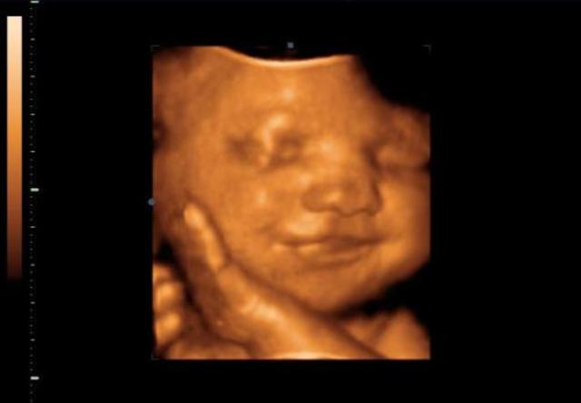 A magzat fejlődése a nyolcadik hónapban