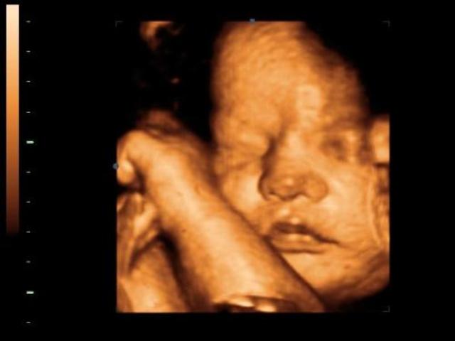 A magzat fejlődése a kilencedik hónapban