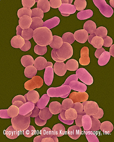 Haemophilus influenzae the first bacterium genome sequenced