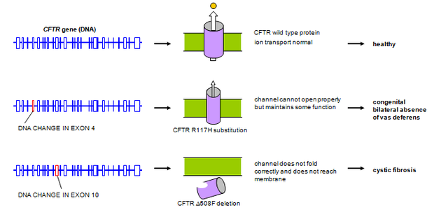 Cystic Fibrosis gene mutation identified