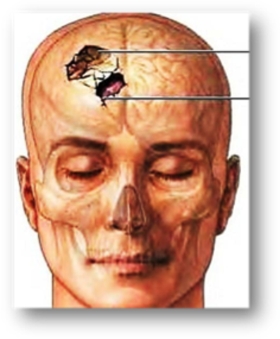 A. Benton y Chitchley