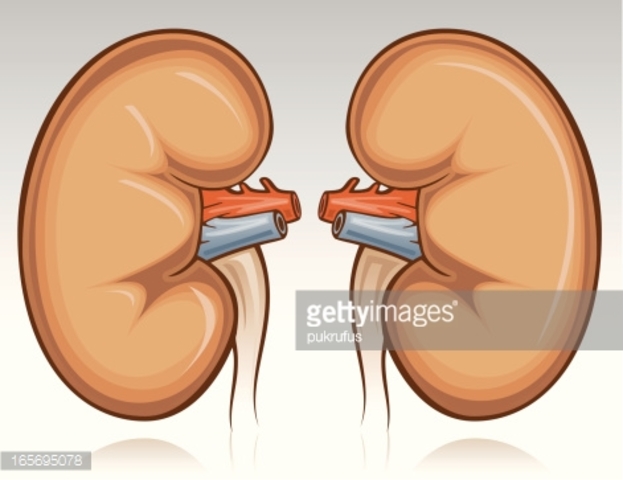 Kidney Transplant