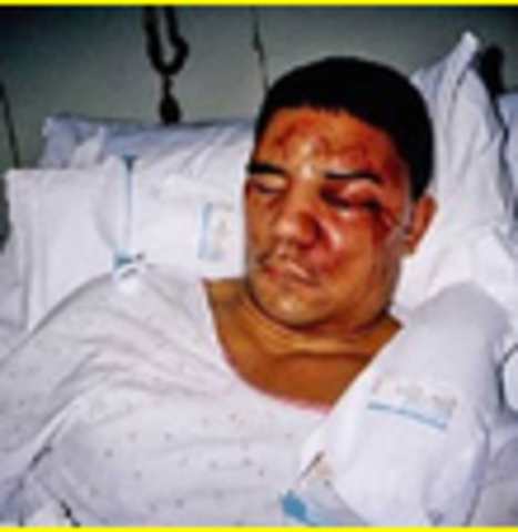 The Frank Jude incident