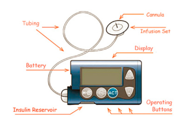 insulin pumps are made easily available, and human insulin is FDA approved