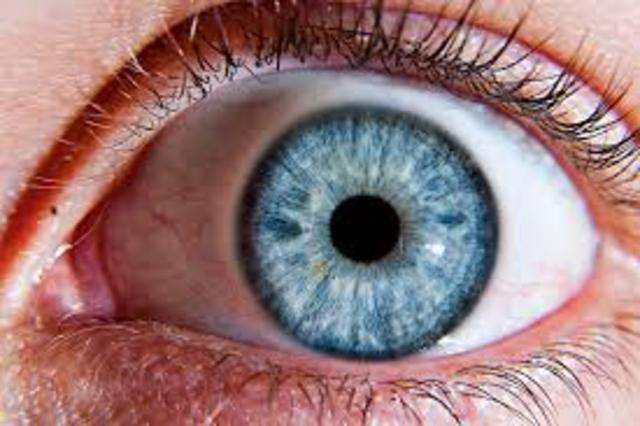 Diagnosed with Uveitis