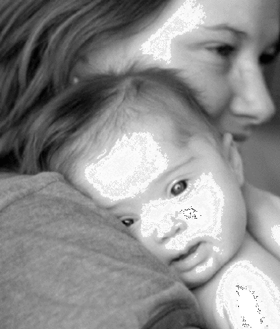 Genetica del sindrome de down