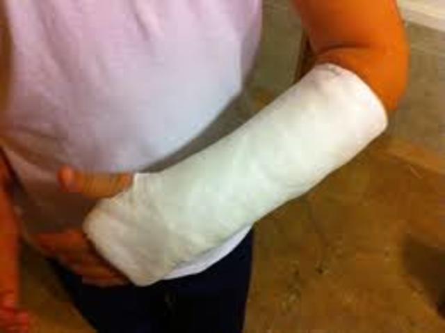 me fracturo la muñeca