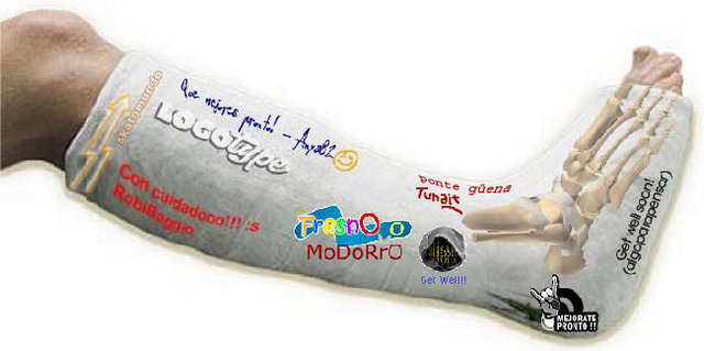 Mi primera vez con yeso