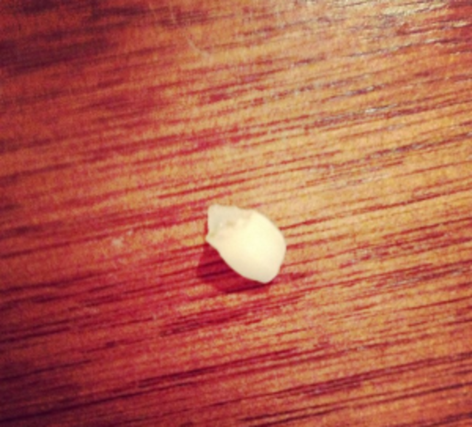 My First tooth Fell