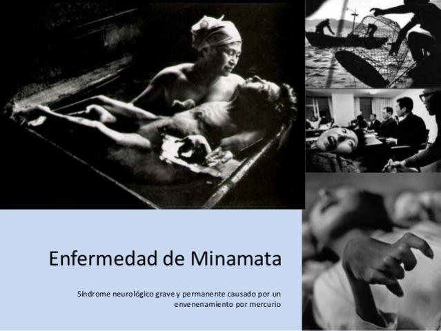 Se aprueba la Ley de medidas especiales de apoyo a las víctimas de la enferemedad de Minamata.
