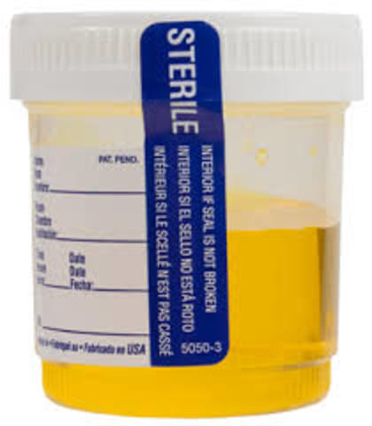 Urine Sample