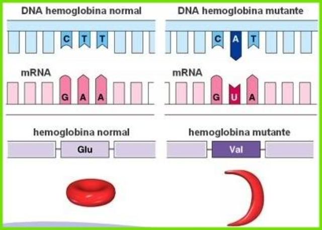 Descubrieron causa de la anemia falciforme