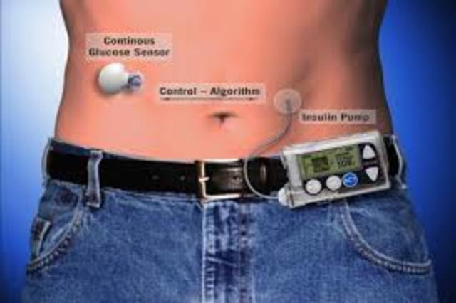 Bionic Pancreas