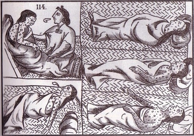 Smallpox