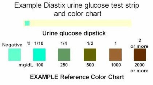 Sugar Found in Urine