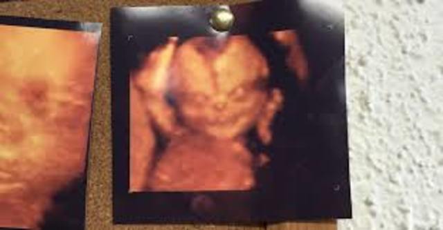 Entered this cruel world.