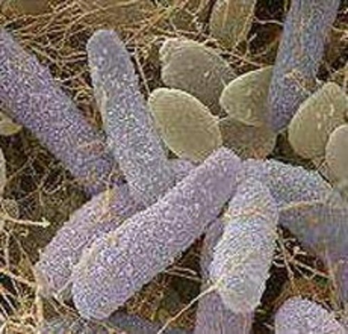 S, A, Forbes publica El lago como microcosmos y describe este medio como un "organismo" complejo.