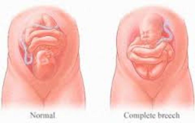 3rd Trimester (29-40 weeks)