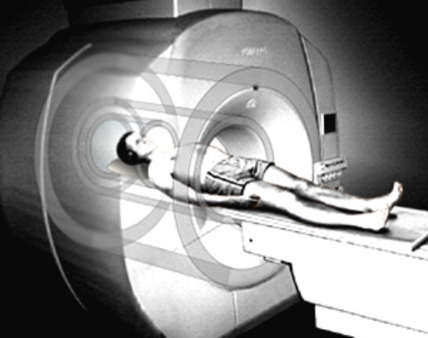 MRI (Magnetic Resonance Imaging)