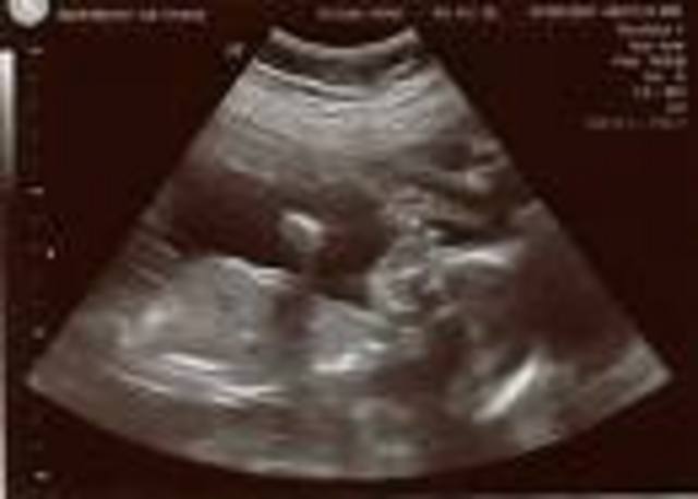 My mom swallowed me!