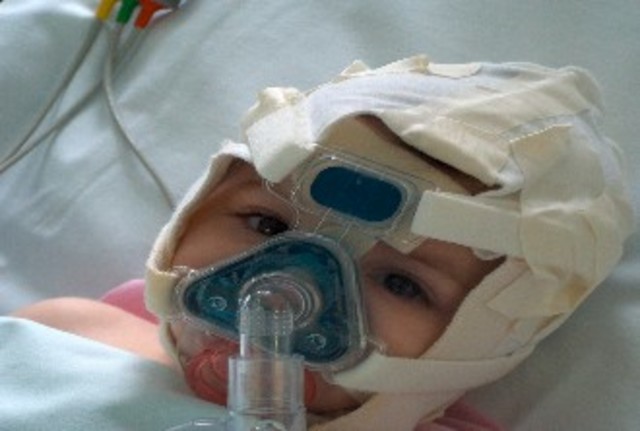 Gregory  la presión de distensión continua