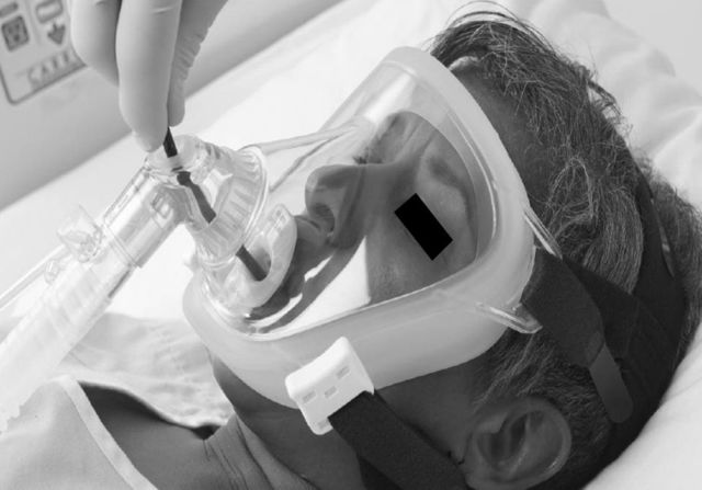 Se comenzó a aplicar VMNI  CPAP