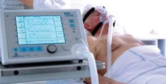 ventilación artificial en humanos  Siglo XVI 1493 -1562 Paracelso y Vesalio