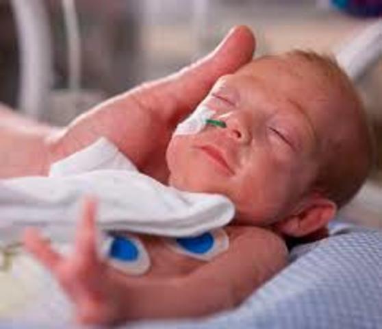 La aplicación de la ventilación mecánica