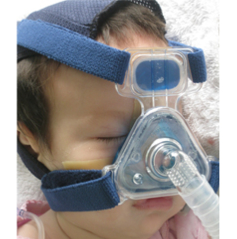 Ventilación a presión positiva