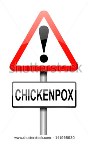 Shingles and Chickenpox are linked????