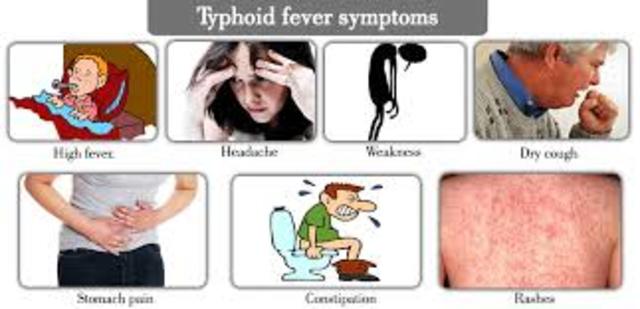 typhoid described