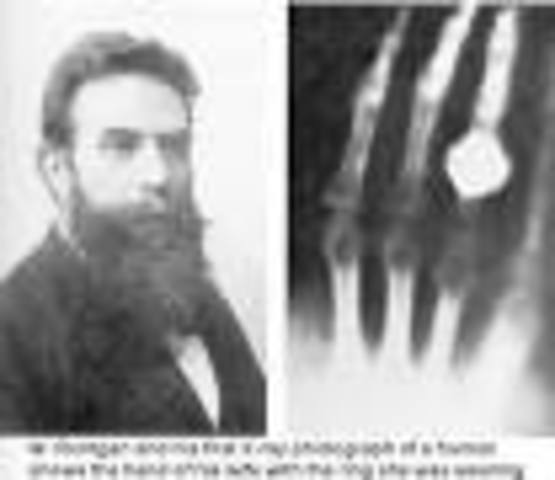 Descubrimiento de los rayos X