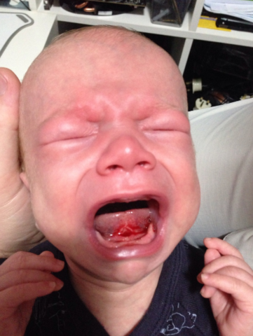 Bit the end of my tongue off