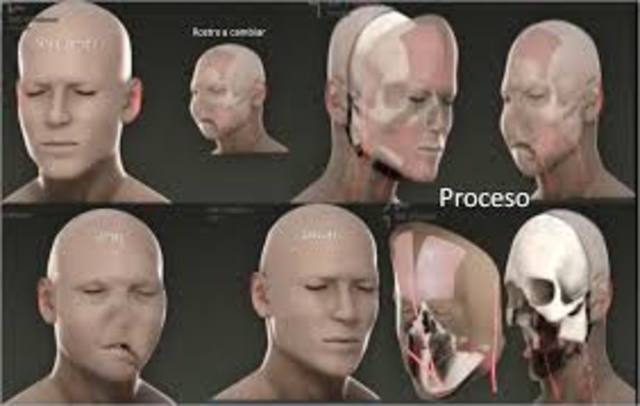 Transplante de un Rostro Humano