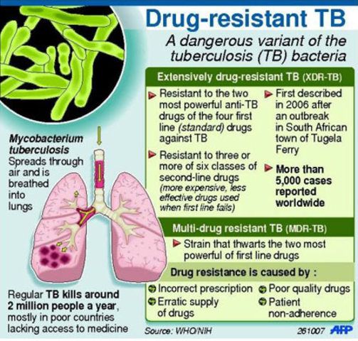 Outbreak of drug-resistant TB