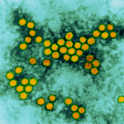 New discovery about Polio