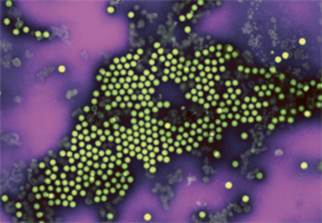 When Polio was eliminated in the U.S.