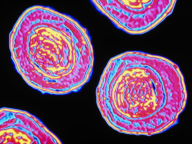 Pertussis First Recognized