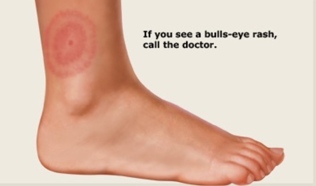 outbreak in South America