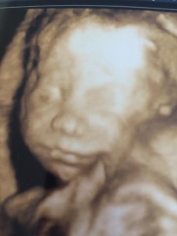 Week Twenty-Six Development