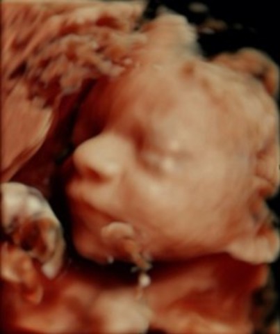 Week Twenty-Eight Progression