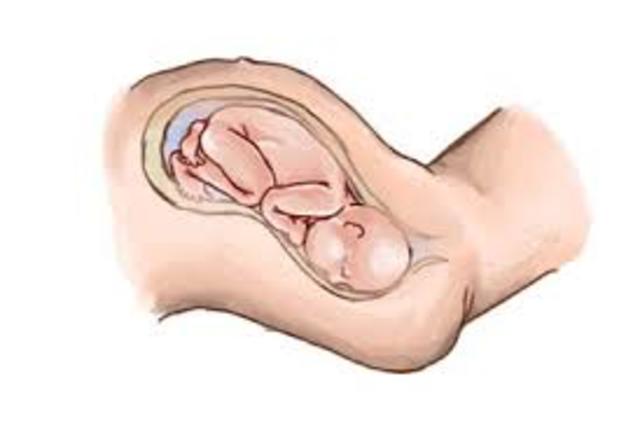 Week Forty Pregnancy