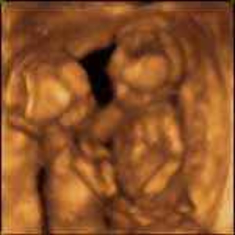 Week 25: Exploration