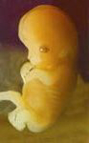 Week 10: Embryo is Now a Fetus