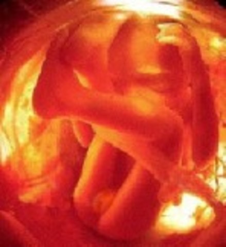 Week 19 of the Second Trimester