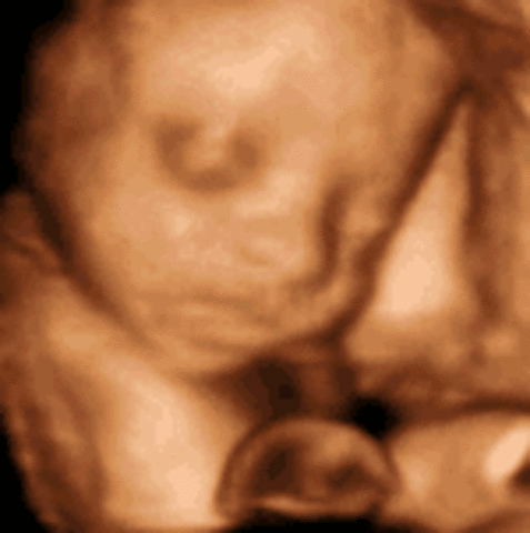 Week 32: Reproductive Development Continues